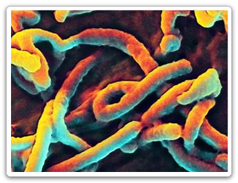 Ebola virus