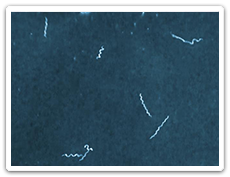 Borrelia burgdorferi